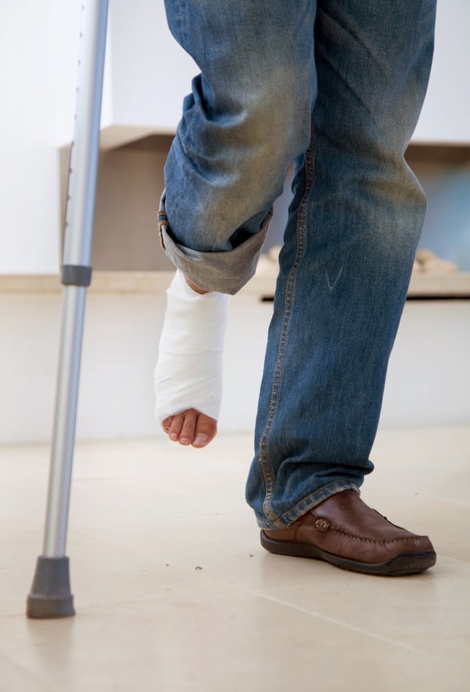 Man with a cast on his leg and crutches Man with a cast on his leg and crutches